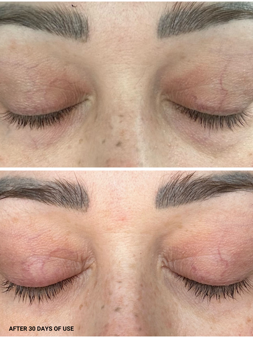 image of before and after of eyelashes with eyelash serum